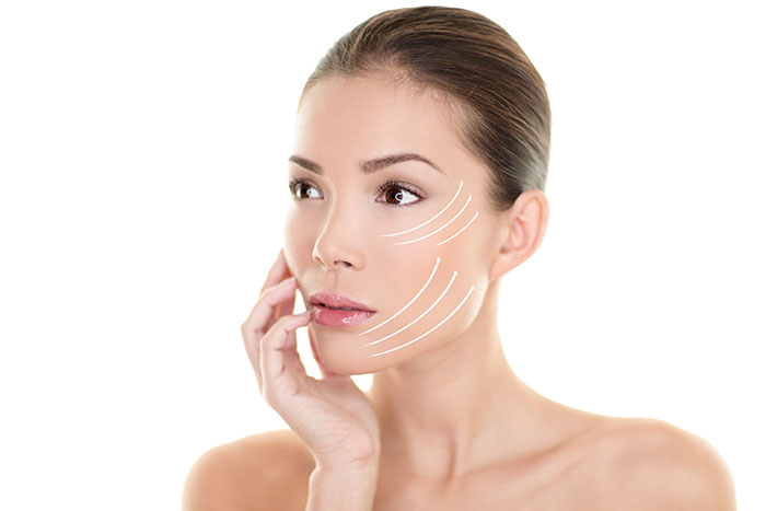PDO Threads in Winston-Salem, NC: Nonsurgical Facelift
