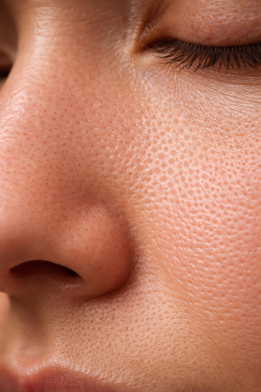 Plasma Treatment for Pores