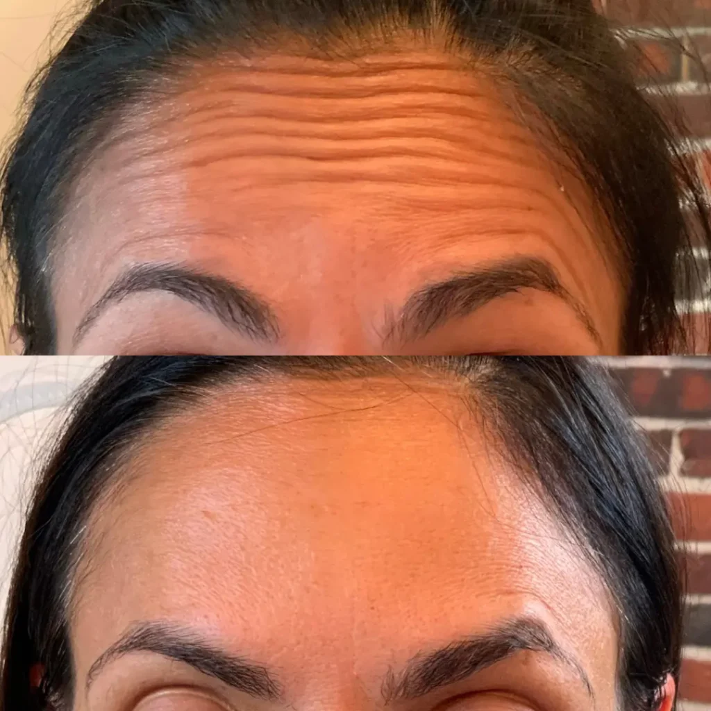 tox before and after