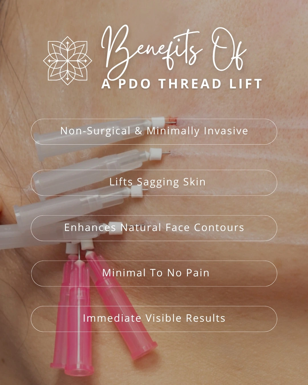 PDO (Polydioxanone) threads benefits